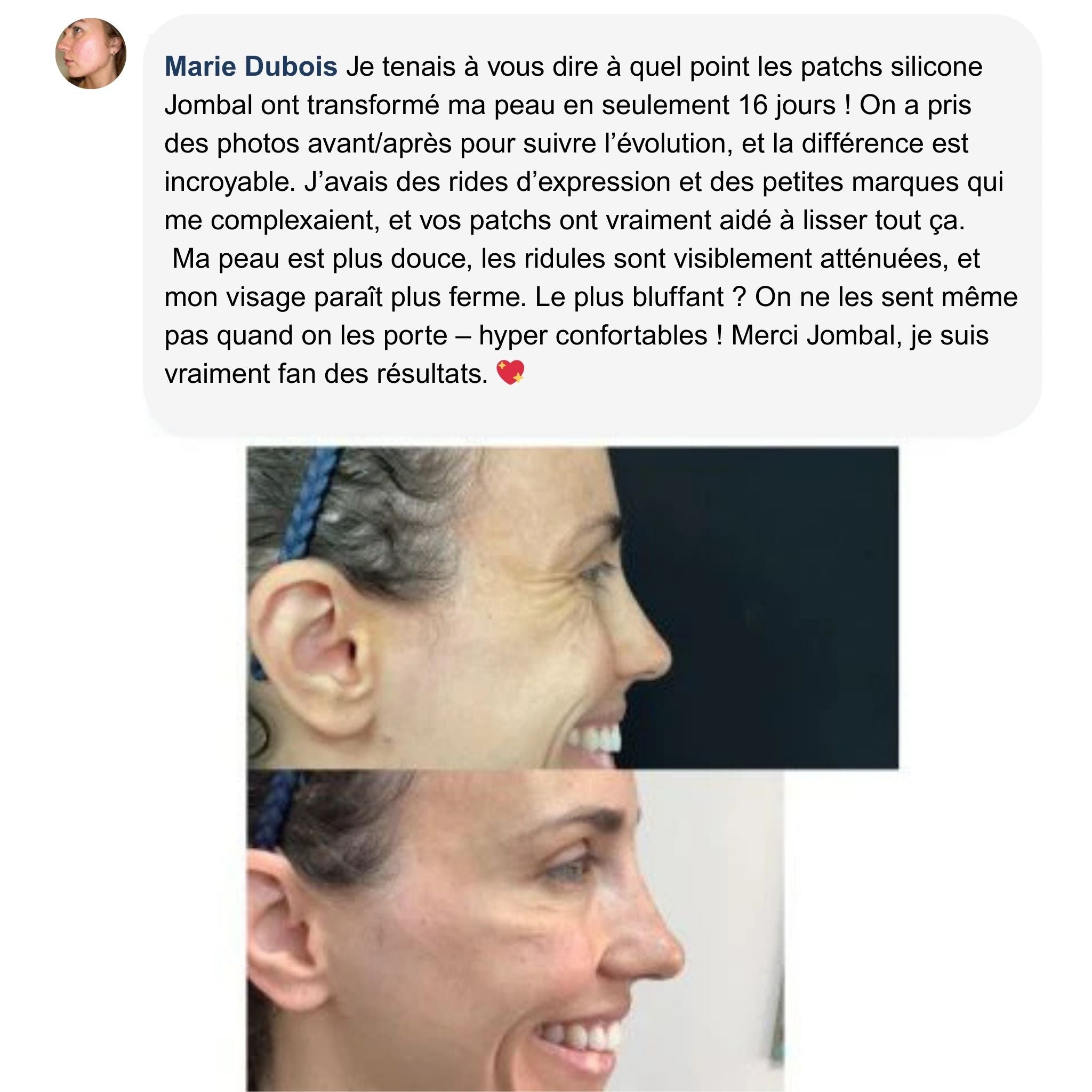 Jombal™ - Feuilles Cicatrisantes en Silicone