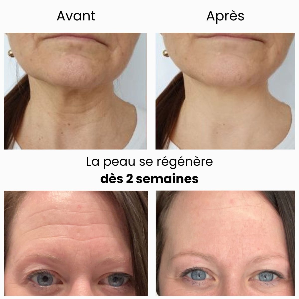 Jombal™ - Bande Silicone Beauté - Jombal